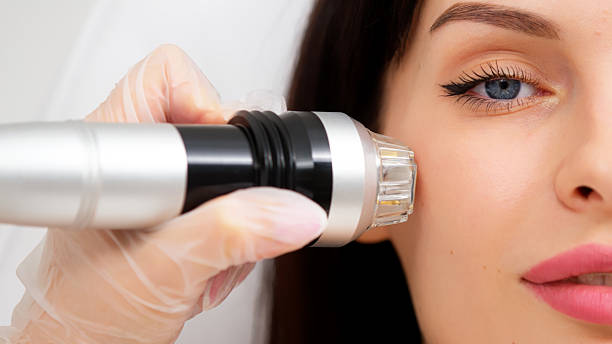 جذب مراجعین کلینیک زیبایی با خدمات لیزر درمانی