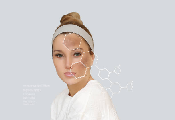 تولید محتوای آموزشی در مورد لکههای پوستی برای سئو کلینیک پوست و مو