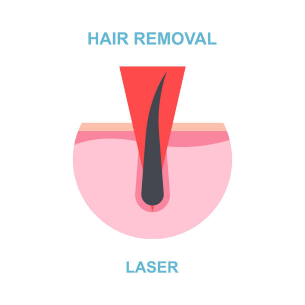 جذب بیمار لیزر درمانی با استراتژی سئو محلی