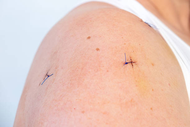 مراقبت پس از جراحی با استفاده از پورتال هوشمند بیمار