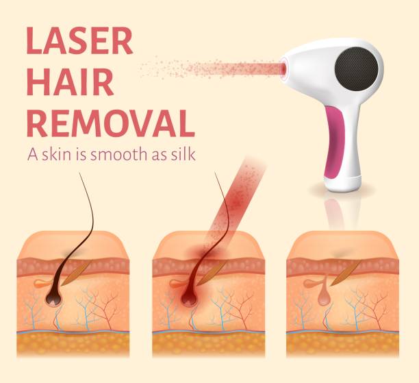 سئو تصویری برای خدمات آنلاین کلینیک پوست و مو مانند لیزر