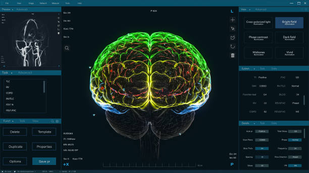 سایت فوق تخصص مغز و اعصاب و نمایش تخصص پزشکی پیشرفته
