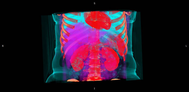سئو تخصصی پزشکی و برندینگ دیجیتال برای مراکز تصویربرداری CT Scan در تبریز: افزایش دیده شدن و جذب مراجعین - تصویر سه بعدی از CT Scan بدن و تکنولوژی رادیولوژی برای سئو تخصصی پزشکی