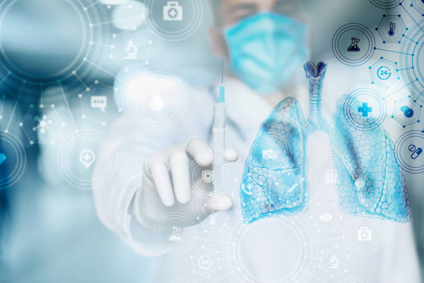 مفهوم درمان بیماریهای ریوی و مراقبتهای ویژه، سئو فوق تخصص ریه