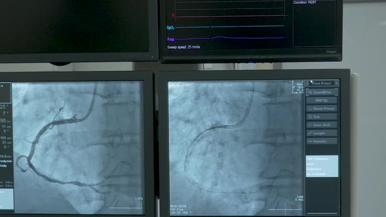 سئو سایت پزشکان و استراتژی سئو پزشکی برای کاردیولوژی اینترونشنال: مانیتورهای ECG و جراح در اتاق عمل
