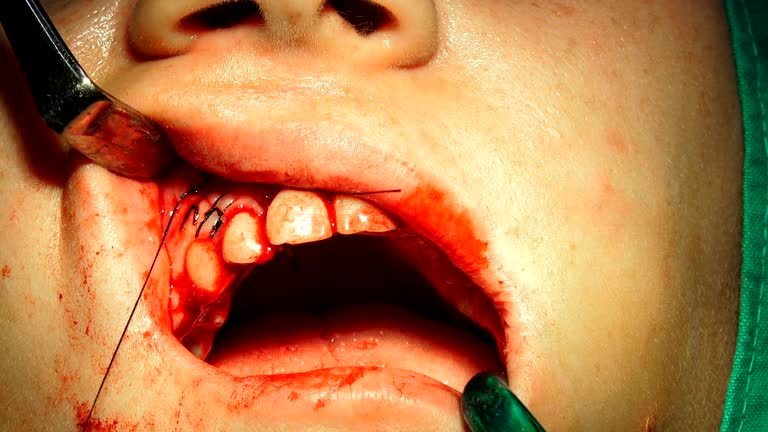 سئو تخصصی پزشکی برای کلینیکهای جراحی دهان، فک و صورت تبریز: تقویت برندینگ دیجیتال پزشکی 2026 - جراحی دهان فک صورت