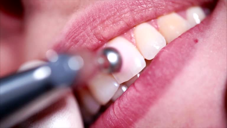 سئو تخصصی پزشکی و بازاریابی دندانپزشکی: تصویر کلوزآپ از دندانپزشک در حال درمان