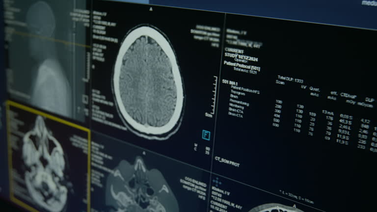 پشتیبانی وبسایتهای درمانی و امنیت وردپرس پزشکی برای مراکز تصویربرداری CT Scan در بندرعباس: تصویر سیتیاسکن مغز روی نمایشگر در مطب رادیولوژیست