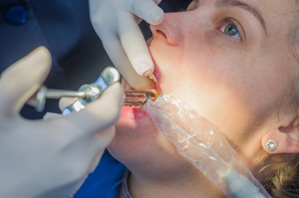 خدمات دندانپزشکی ترمیمی و زیبایی در مشهد - ایمپلنت و پروتزهای دندانی