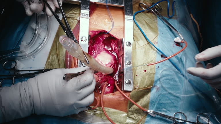 فوق تخصص قلب و عروق در حال انجام جراحی، نیازمند پشتیبانی قوی CRM پزشکی برای مدیریت بیمار - طراحی پرتال نوبتدهی آنلاین و CRM پزشکی برای فوق تخصص قلب و عروق و اینترونشنال کاردیولوژی در تهران: بهینهسازی مدیریت مطب ۲۰۲۶