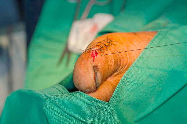 جراحی محدود، طراحی UX بیماران، ارتقاء نوبت دهی آنلاین، افزایش اعتماد بیمار