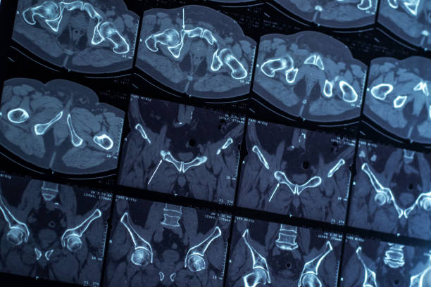 تصویر از نزدیک از دستگاه MRI در حال انجام اسکن بدن، نمایشگر پیشرفت تکنولوژی در مراکز تصویربرداری MRI و نیاز به نرم افزار مدیریت پزشکی