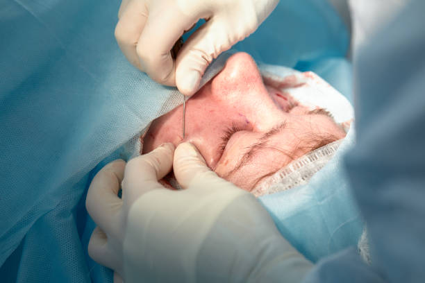 یکپارچهسازی CRM پزشکی و نرمافزارهای مدیریت مطب برای کلینیکهای جراحی دهان، فک و صورت در اصفهان: افزایش نوبتدهی آنلاین 2026 - جراح در حال انجام عمل جراحی بر روی صورت بیمار