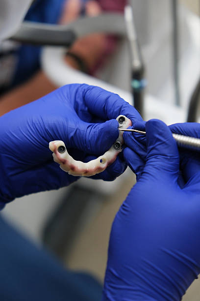 دندانپزشکی ایمپلنت در اصفهان - آمادگی برای ایمپلنت