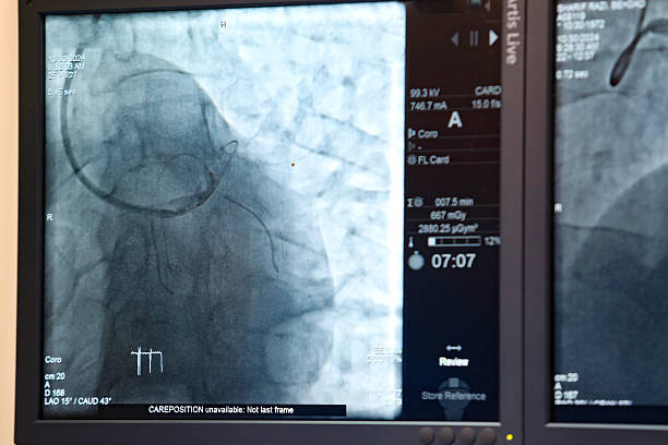 نرم افزارهای مدیریت مطب و CRM پزشکی برای فوق تخصص قلب و عروق در رشت: نمایش تصویر آنژیوگرافی روی مانیتور، مدیریت کلینیک قلب