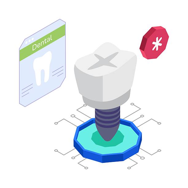 تصویر ایزومتریک درمان ایمپلنت دندان، محتوایی برای سئو ایمپلنت دندان و جذب بیمار