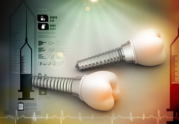 سئو تخصصی پزشکی و برندینگ دیجیتال برای کلینیکهای ایمپلنت در کرج: ایمپلنت دندان
