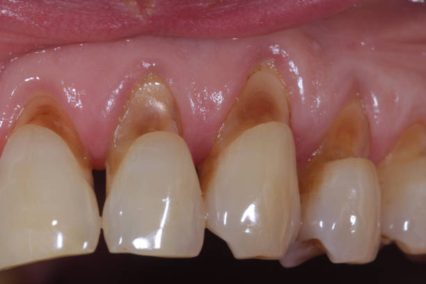 بهینه سازی سایت دندانپزشک و مشاوره سئو پزشکی برای درمانهای لثه و ریشه