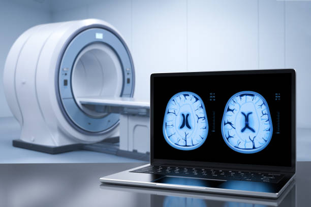 تصویر اشعه ایکس مغز روی صفحه لپتاپ - سئو پزشکی تخصصی و بازاریابی آنلاین مراکز MRI