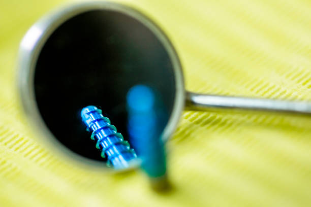 ایمپلنت دندان و سئو ایمپلنت دندان برای کلینیکهای تبریز