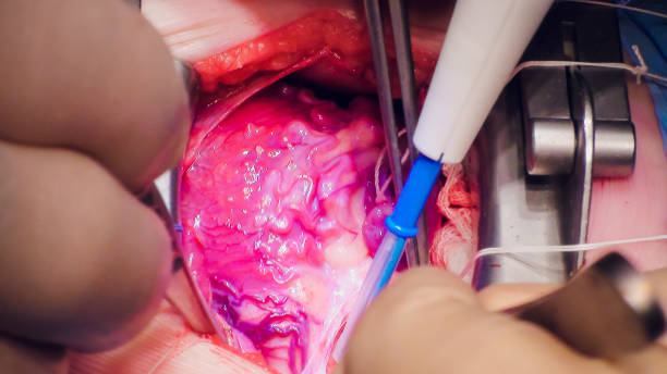 دکتر در حال انجام عمل جراحی پیوند قلب - فوق تخصص قلب و عروق و مدیریت مطب هوشمند