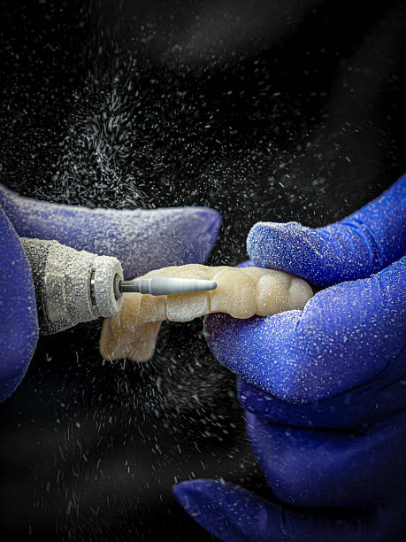 جذب بیمار ایمپلنت دندان از طریق سئو و نوبتدهی آنلاین