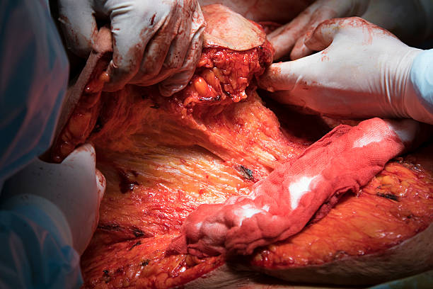 فوق تخصص گوارش و کبد در اصفهان - تصویر بافت بدن انسان