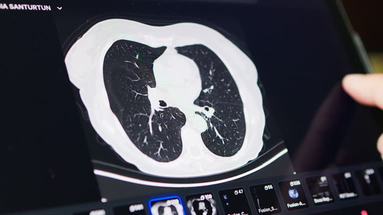 طراحی سایت پزشکی با UX بیمارمحور - تصویر اسکن پزشکی برای بیمار ریه