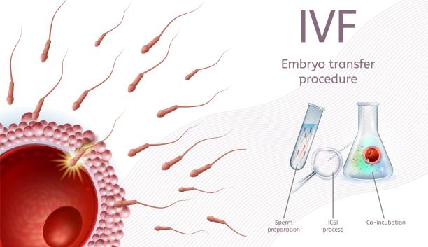 فرآیند انتقال جنین در درمان ناباروری IVF: برندینگ دیجیتال پزشکی و ساخت وبسایت سلامت