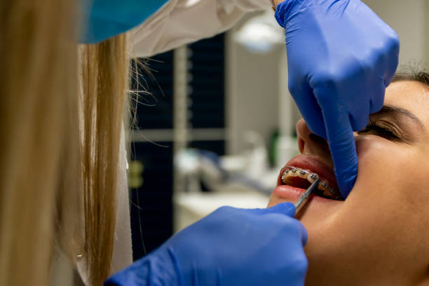 سئو سایت پزشکان و نوبتدهی آنلاین هوشمند برای کلینیکهای ارتودنسی در اهواز: مراحل نصب بریس ارتودنسی و لبخند زیبا