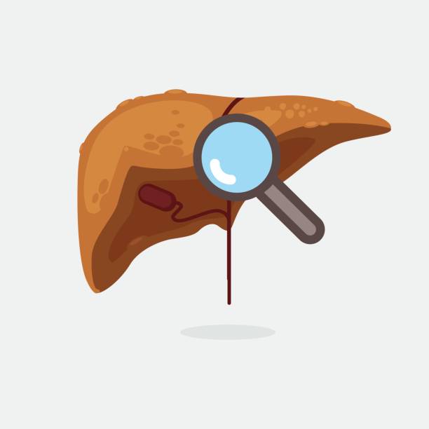 تصویر وکتور کبد آسیب دیده و سیروز کبدی با عنوان سئو کبد و گوارش