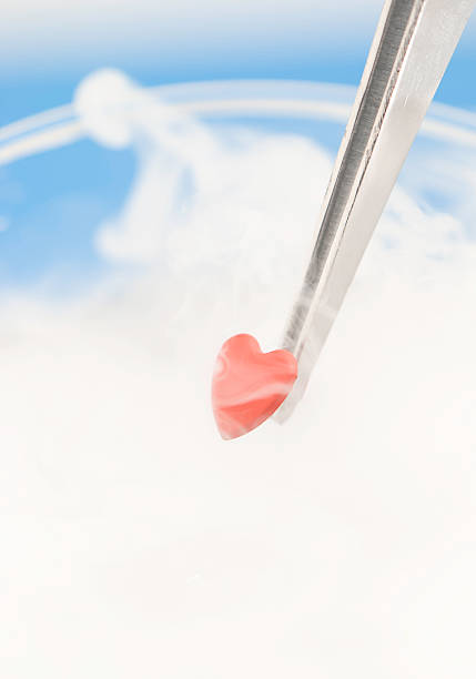 جذب بیمار IVF - قلب فلزی در حال برداشتن از نیتروژن مایع