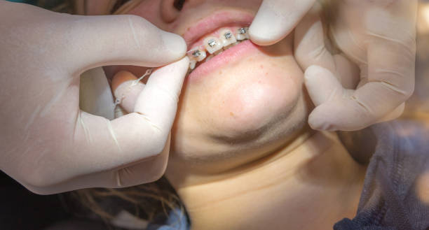 برندینگ دیجیتال پزشکی و سئو سایت پزشکان ارتودنسی در اصفهان: افزایش بیماران ارتودنسی و استراتژی جذب بیمار پزشکان