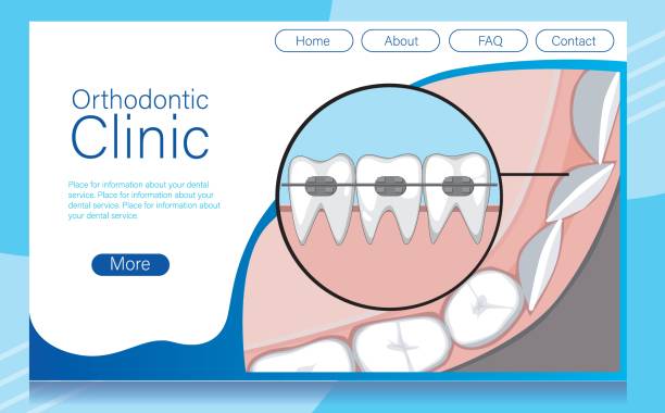 طراحی سایت پزشکی با وردپرس برای کلینیکهای ارتودنسی در اصفهان: بهینهسازی تجربه کاربری بیماران و تسهیل دسترسی آنلاین 2026، تصویر دندان با بریس