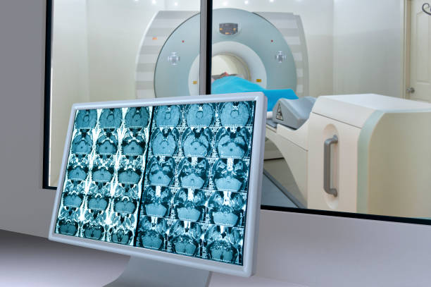 مانیتور اسکن پزشکی برای مراکز تصویربرداری MRI در یزد و ارتقای تجربه کاربری بیماران
