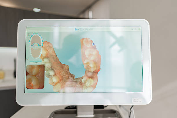 سئو کلینیک دندانپزشکی در شیراز - ایمپلنت دندان دیجیتال