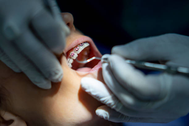 سئو تخصصی پزشکی و نوبتدهی آنلاین هوشمند برای کلینیک ارتودنسی در مشهد: جذب بیماران و افزایش رضایت 2026 - بیمار در حال ارتودنسی دندان با متخصص