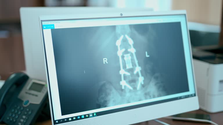 طراحی سایت پزشکی و بهینهسازی UX بیماران برای مراکز رادیولوژی و سونوگرافی در رشت: نوبتدهی آنلاین هوشمند 2026 - اسکن اشعه ایکس بیمار و نمایش تصویر بر روی صفحه در کلینیک