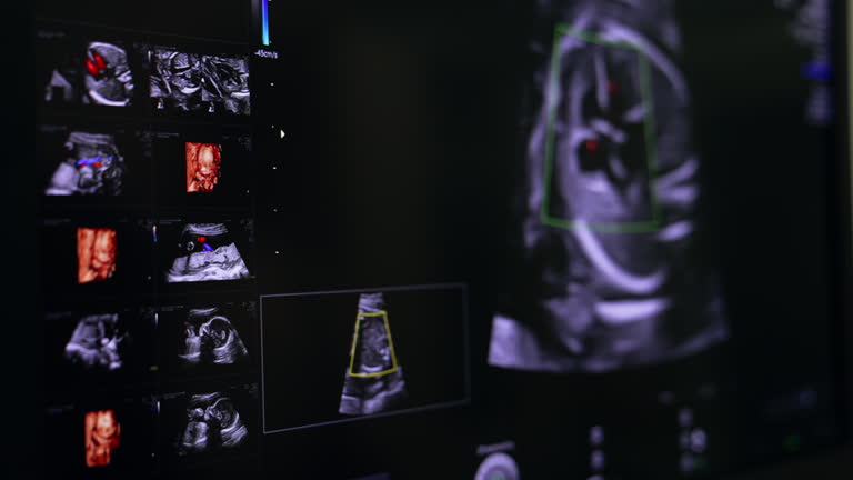 تصویر جنین متولد نشده روی صفحه دستگاه سونوگرافی - مراکز تصویربرداری سونوگرافی و پشتیبانی وبسایت سلامت