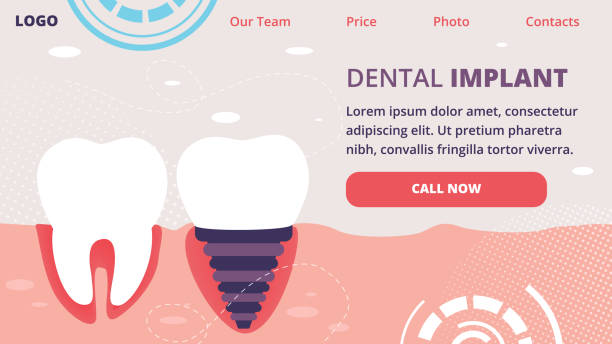 چگونه با سئو پزشکی در شیراز، بیماران بیشتری برای خدمات ایمپلنت دندان جذب کنید؟ - سئو ایمپلنت دندان شیراز