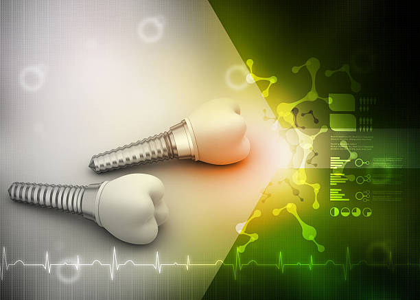 خدمات ایمپلنت دندان در شیراز - افزایش اعتماد بیماران از طریق برندینگ دیجیتال دندانپزشکی