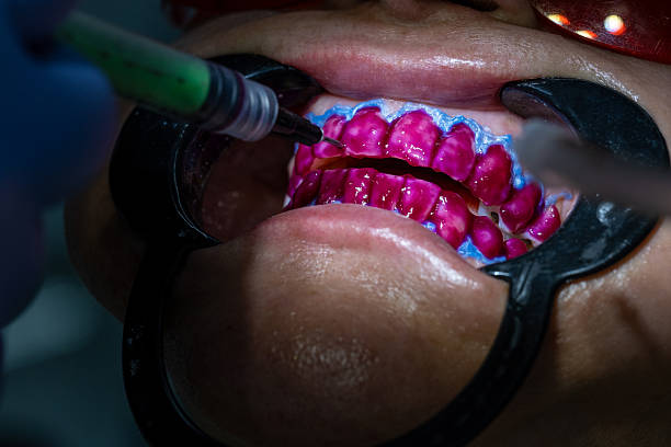 افزایش نوبتدهی دندانپزشکی زیبایی در تهران با استراتژیهای نوین سئو سایت پزشکان 2026 - انجام بلیچینگ دندان در کلینیک دندانپزشکی