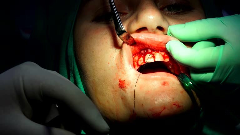 دندانپزشک در حال بخیه پس از جراحی، پشتیبانی وبسایت کلینیک جراحی دهان و فک و صورت مشهد