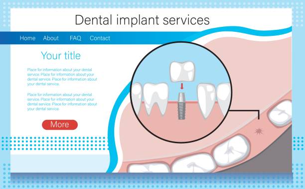 طراحی سایت پزشکی با وردپرس برای کلینیکهای ایمپلنت دندان در کرج: طرح وبسایت با خدمات کاشت دندان