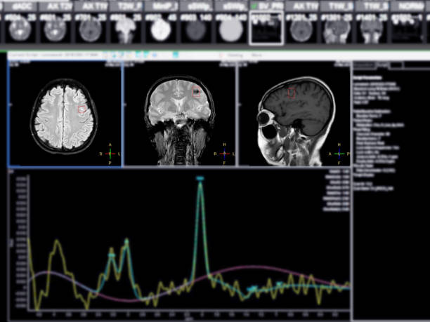 توسعه وب پزشکی و بهینهسازی نوبتدهی آنلاین برای MRI اصفهان: دقت در تشخیص با فناوری پیشرفته